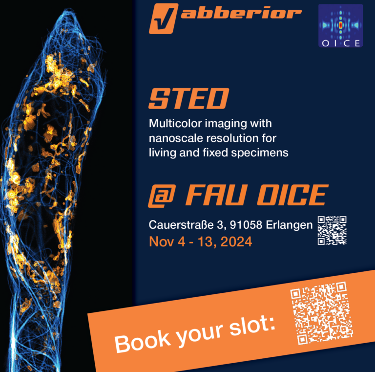 Super-Resolution Hands-On Workshop at FAU OICE November 2024